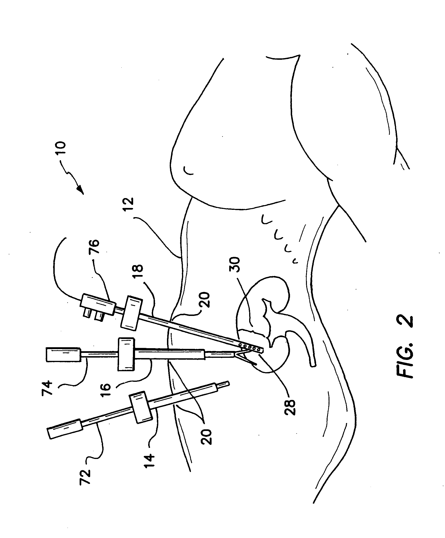Multiple function surgical device