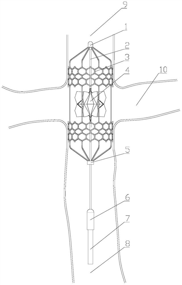 Transcatheter implantation flexible double-cavity auxiliary device for providing circulating power for Fontan patient