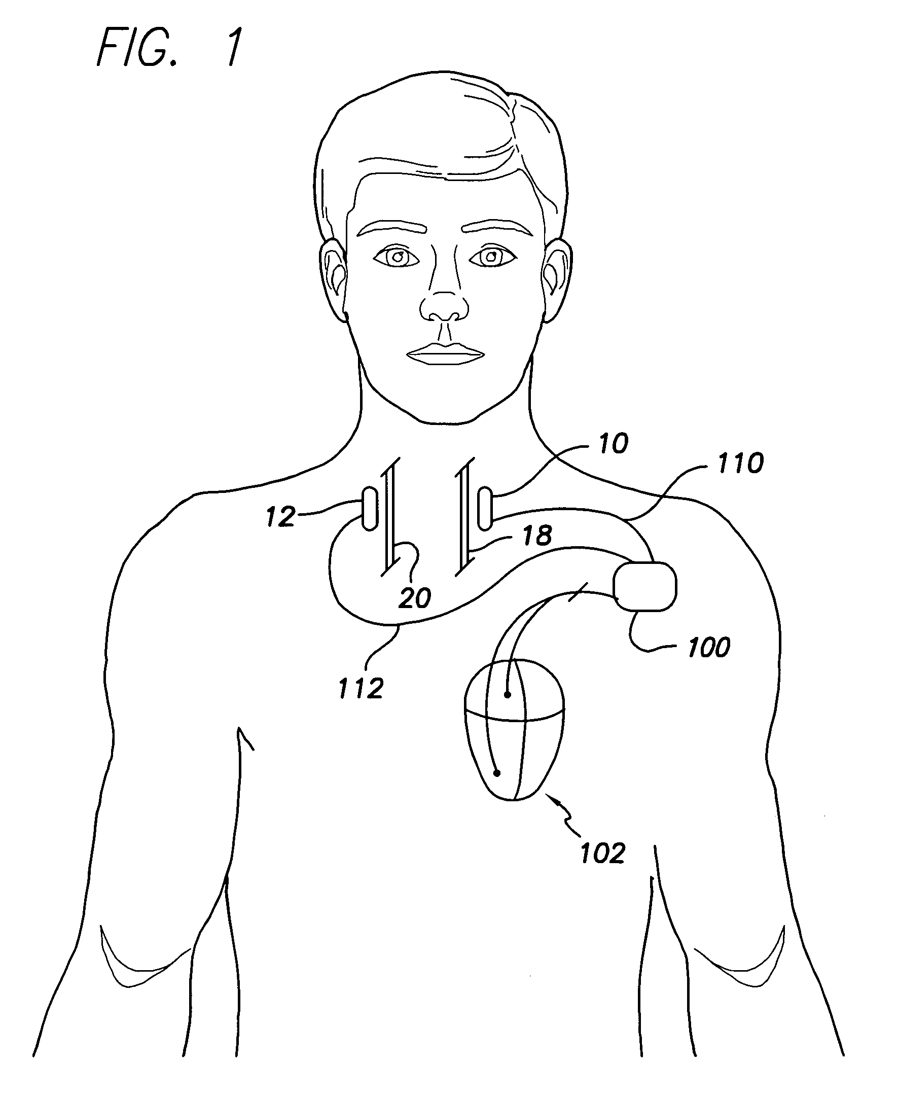 Capture verification in respiratory diaphragm stimulation