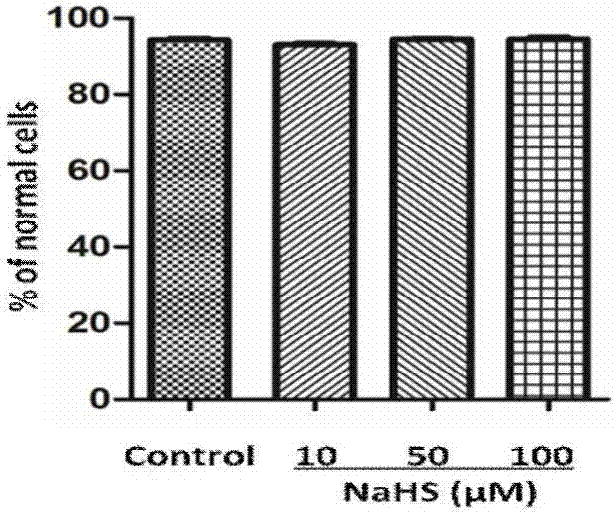 Application of sodium hydrosulfide serving as hydrogen sulfide donor in drug preparation