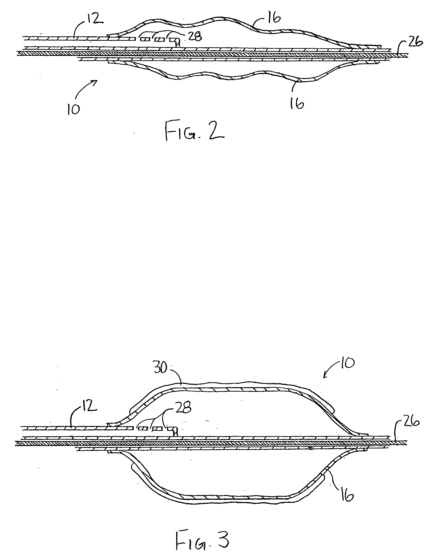 Application of a therapeutic substance to a tissue location using a porous medical device