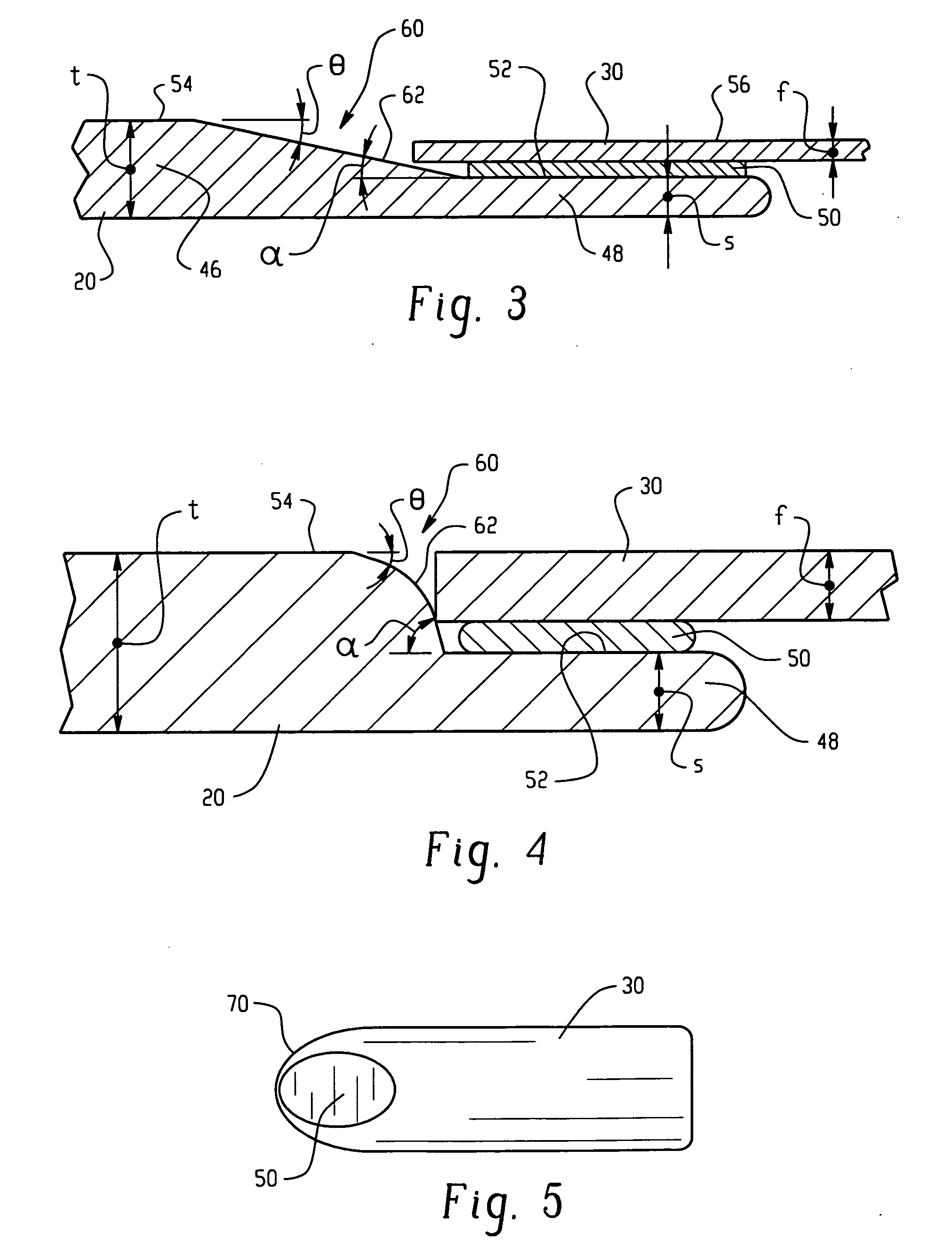 Electrode-foil interface structure