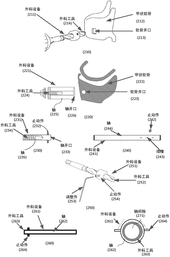 Methods and devices for treating glottic insufficiency