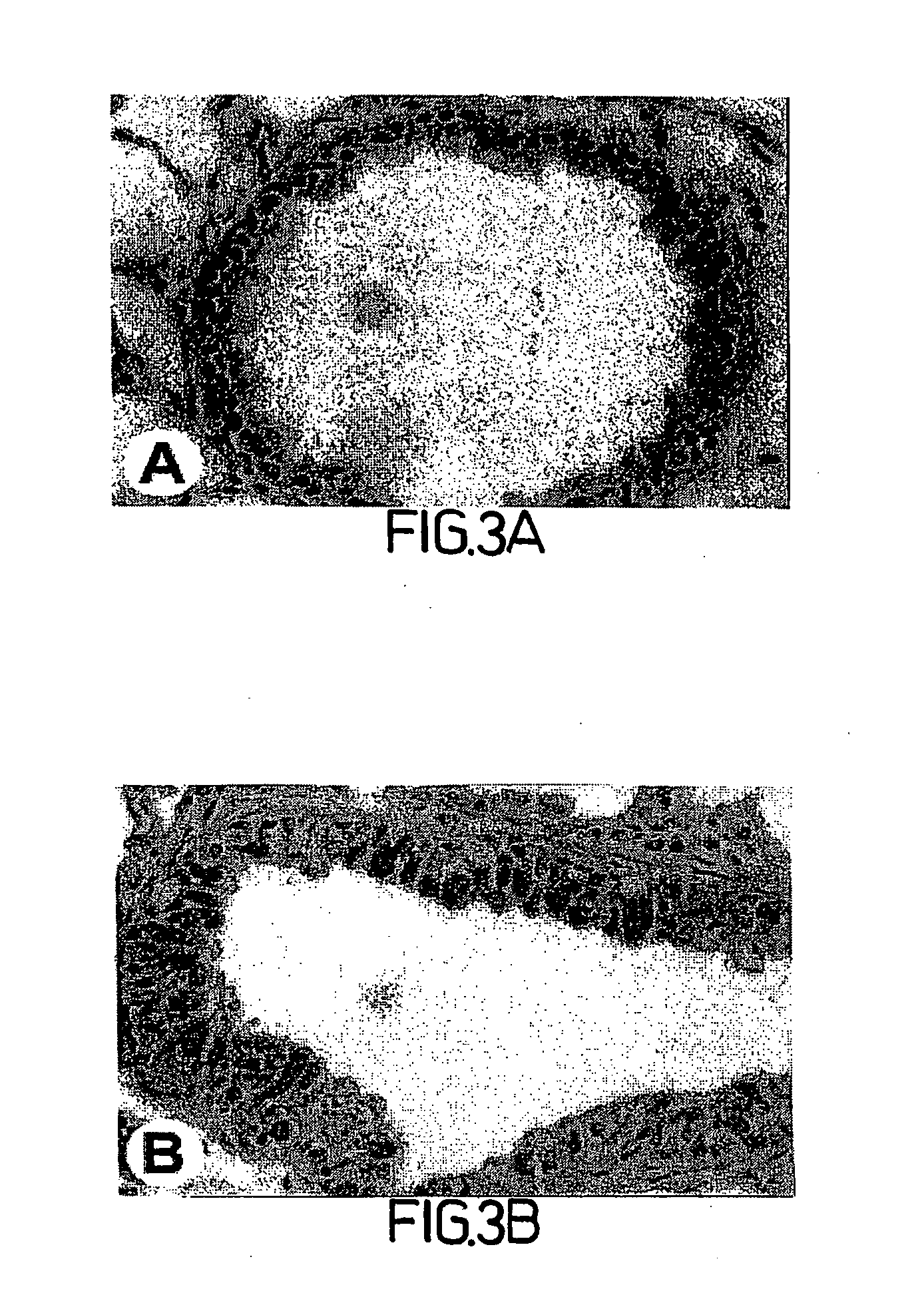Methods, compositions and kits relating to chitinases and chitinase-like molecules and inflammatory disease