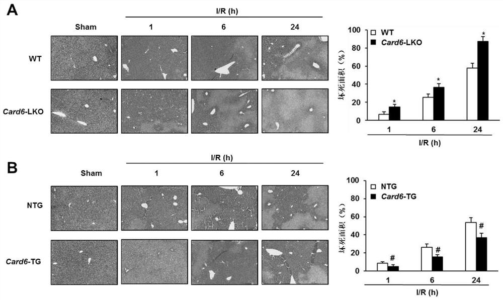 Application of caspase recruitment domain protein 6 (card6) in liver ischemia-reperfusion injury