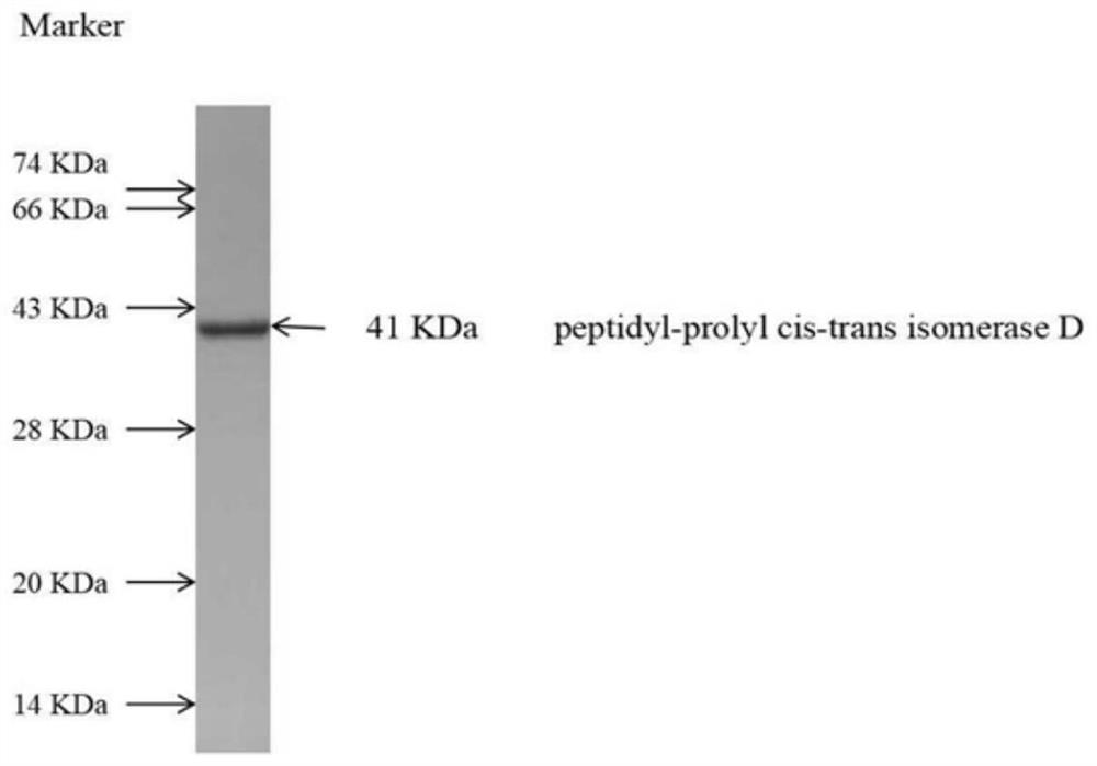 Detection kit for anti-peptidyl prolyl cis-trans isomerase D-IgG antibody