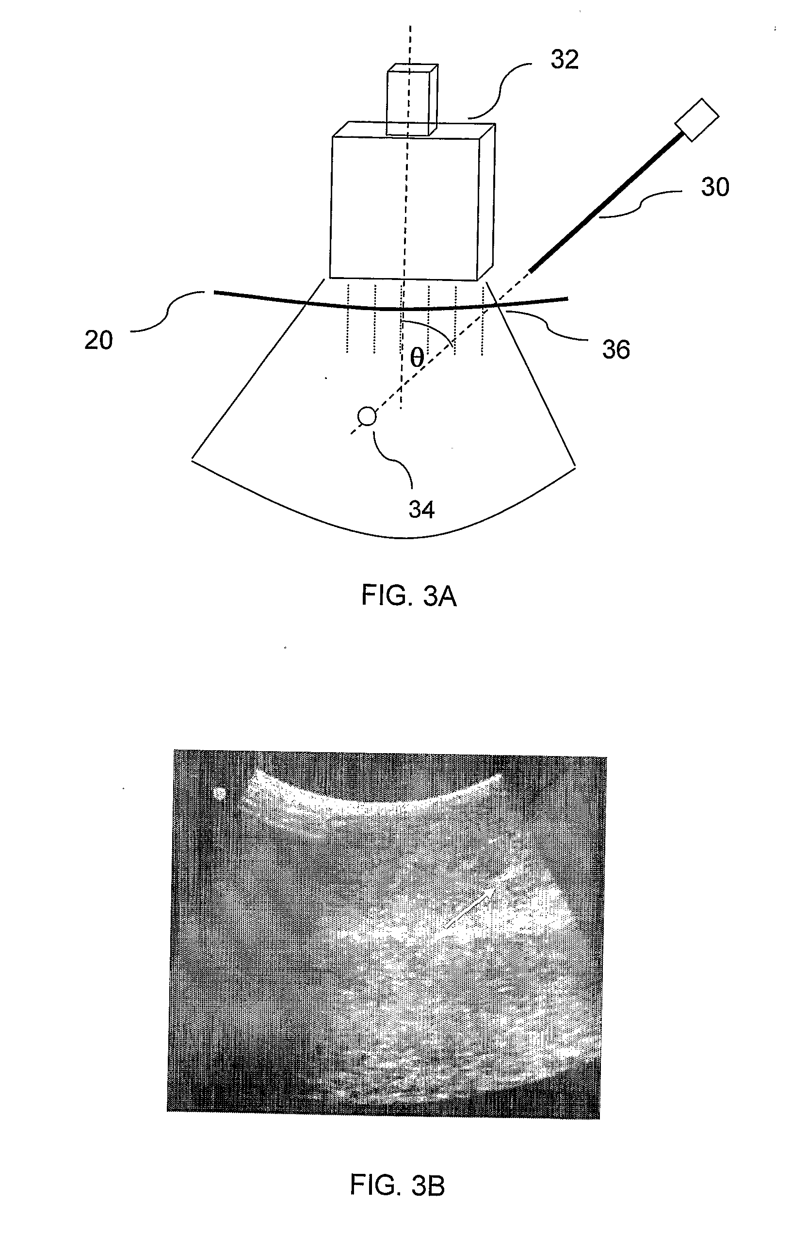 Ultrasound guided robot for flexible needle steering