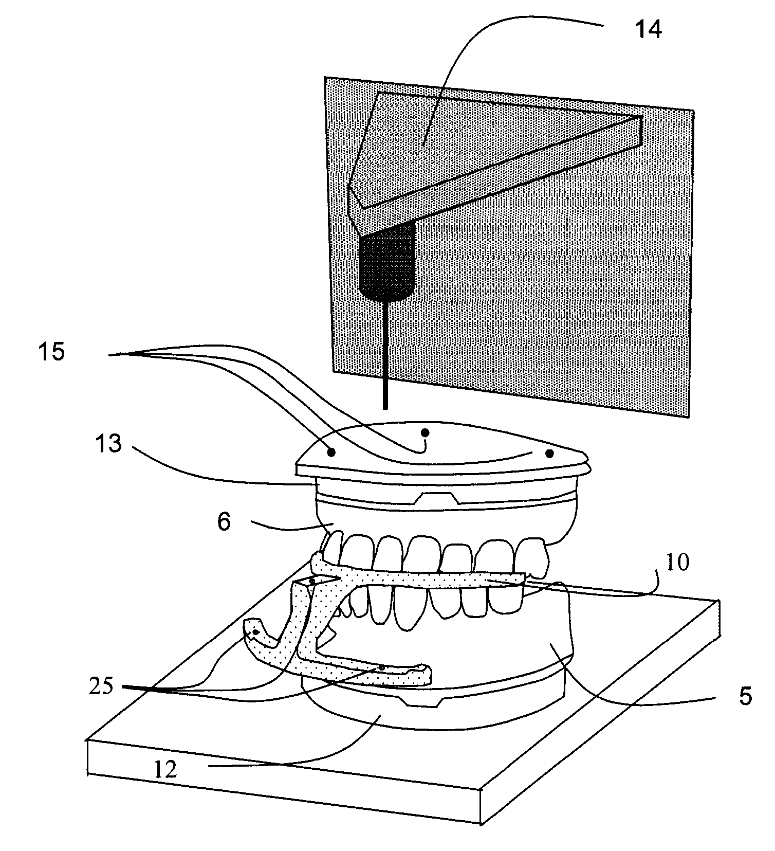 Surgical guides and methods for positioning artificial teeth and dental implants