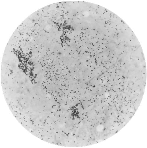 Strain for producing chitinase and application of strain