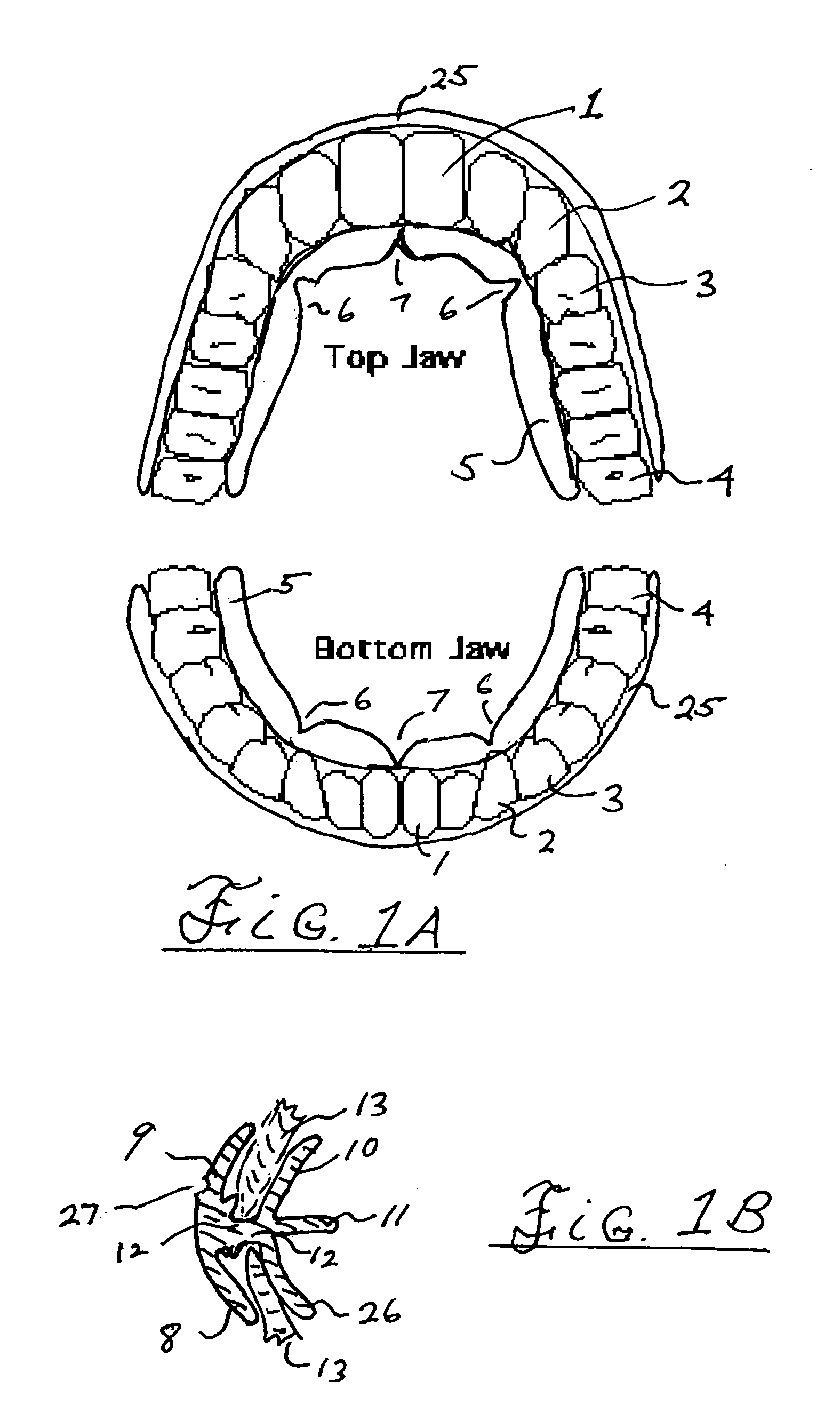 Method and system for swallow control resulting in improved posture