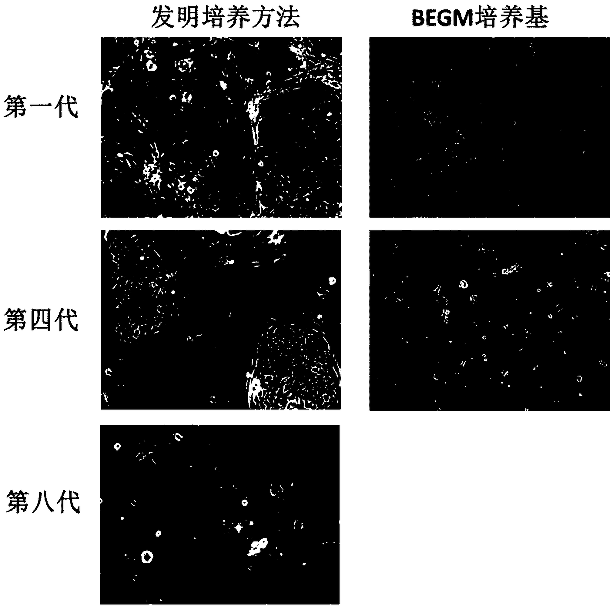 Nose epithelial stem cell culture method and nose epithelial stem cell proliferation medium