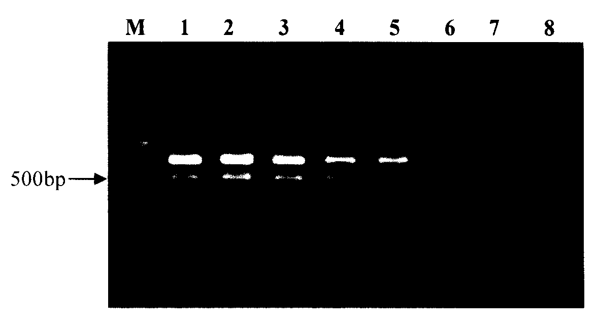 Multiple PCR rapid detection kit and detection method for pathogen in aquatic products