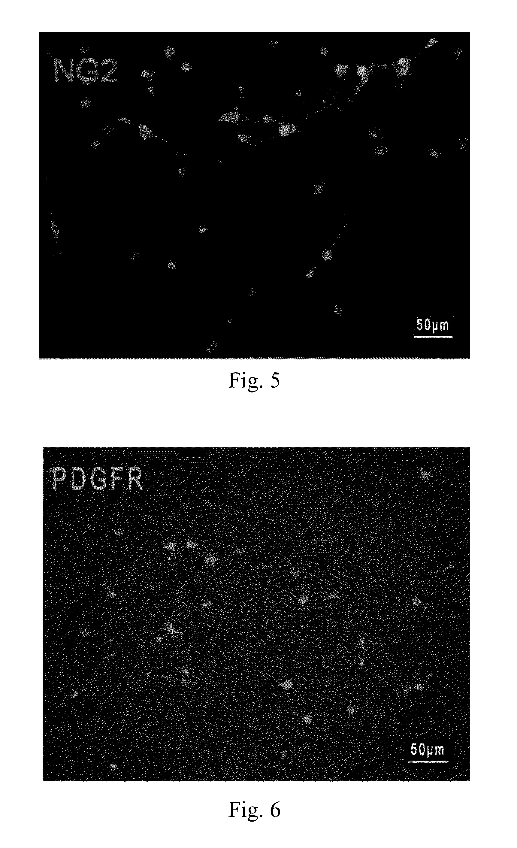 Differentiation and amplification method for inducing human neural
stem/progenitor cells to differentiate into oligodendrocyte progenitor cells and
application thereof