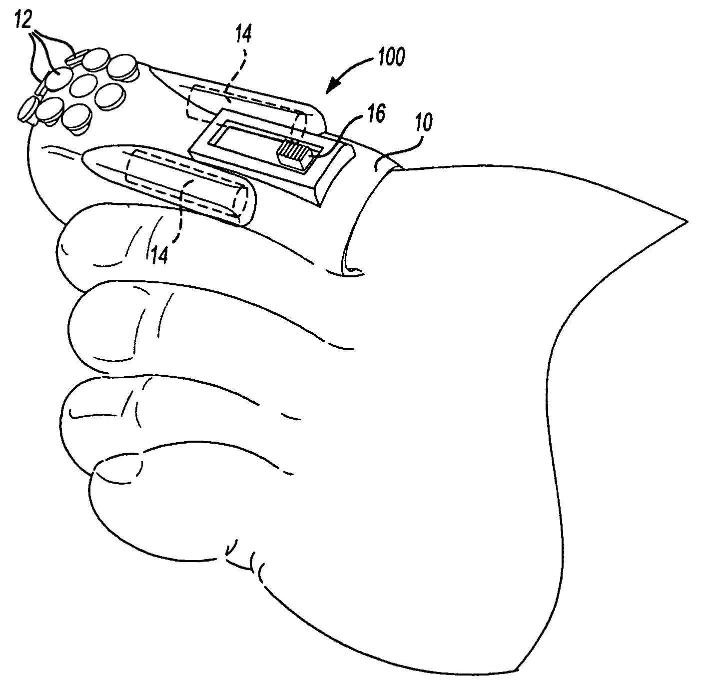 Therapy and device for treatment of nail infections