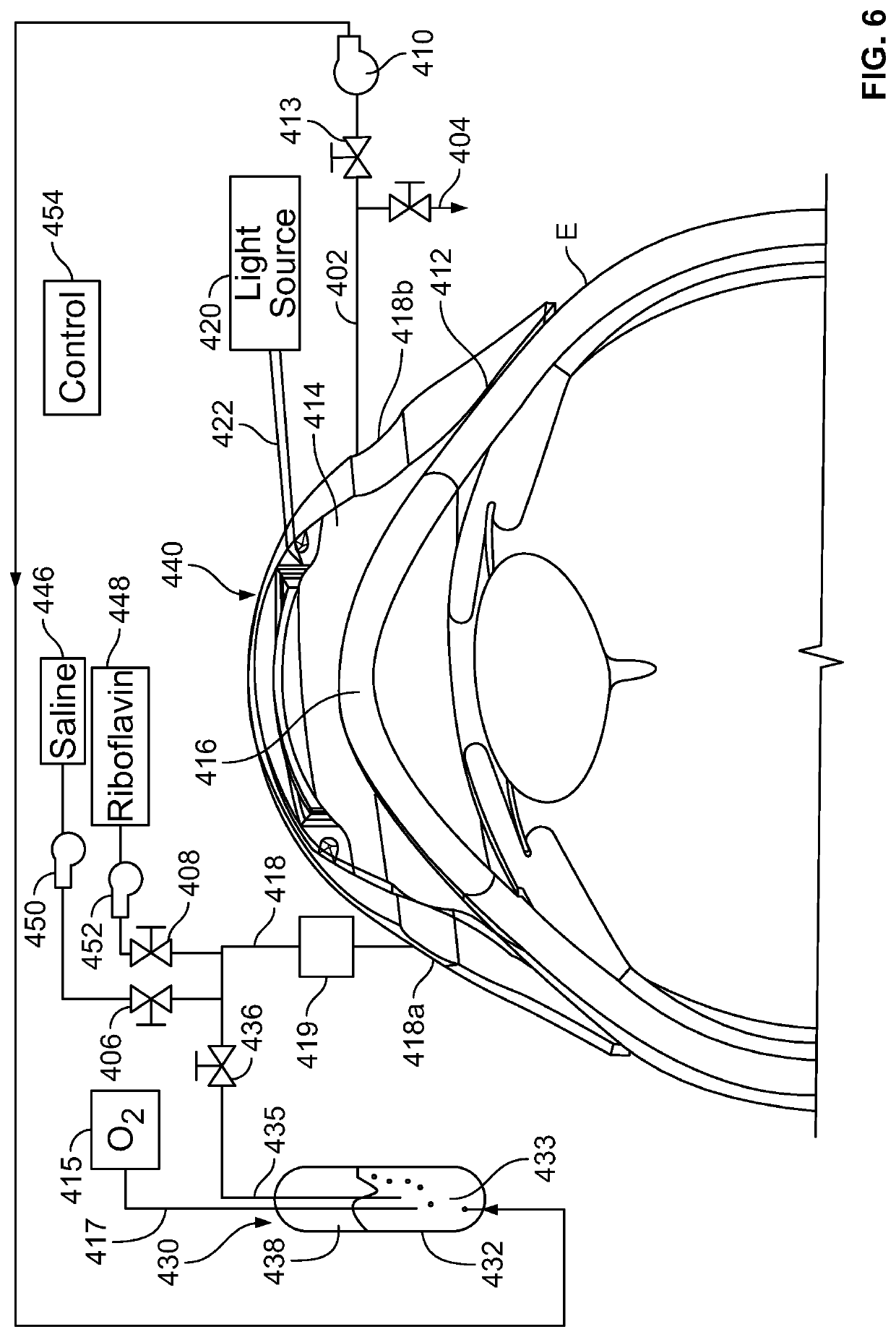 Corneal Crosslinking With Catalyst Distribution Control