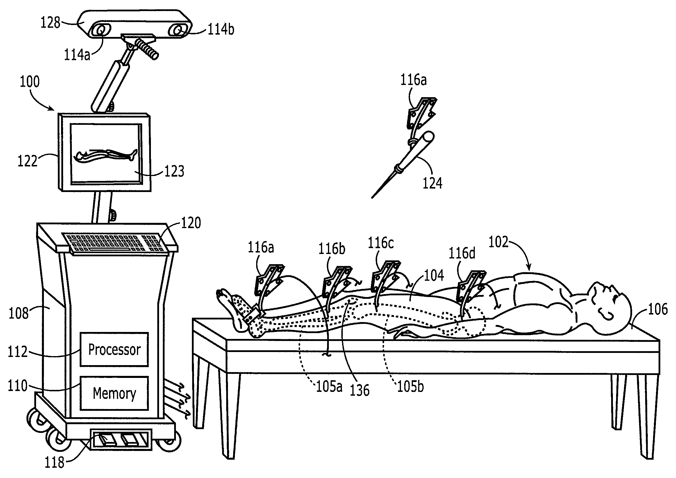 Method and apparatus for positioning a bone prosthesis using a localization system