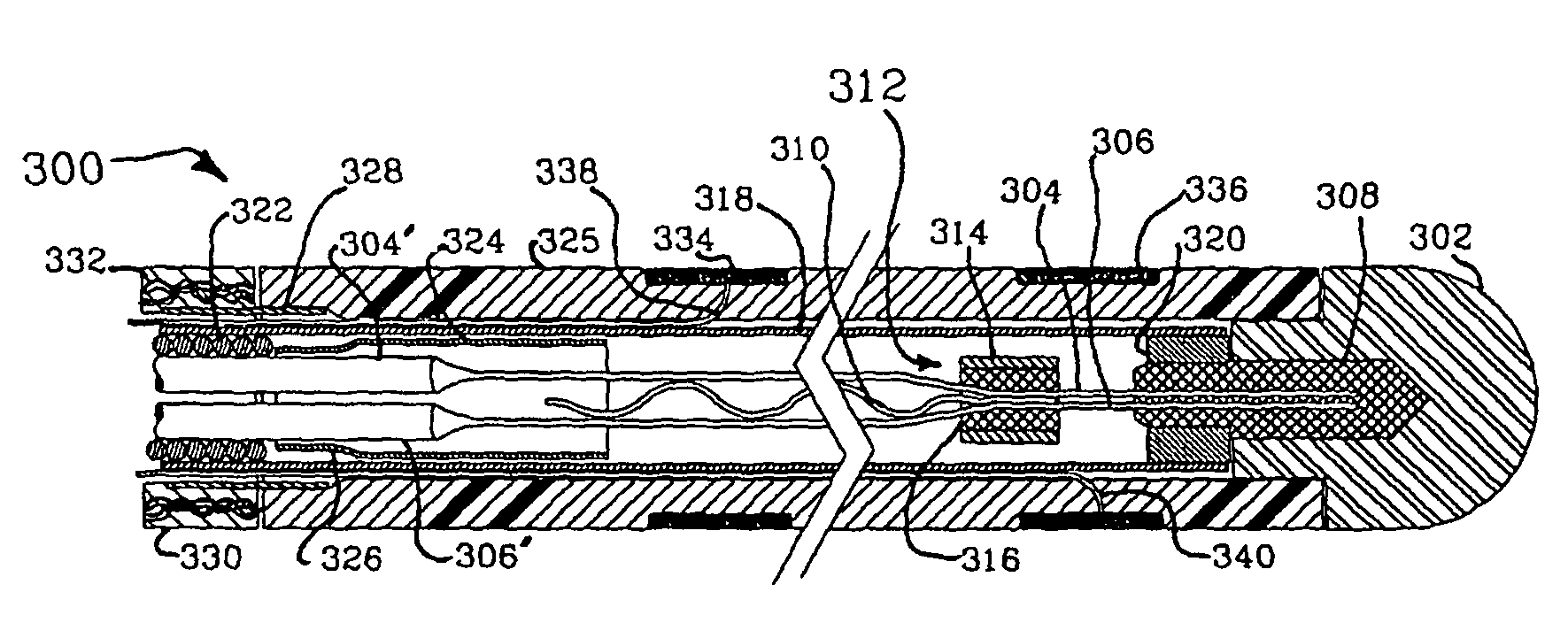 Electrophysiology/ablation catheter and remote actuator therefor