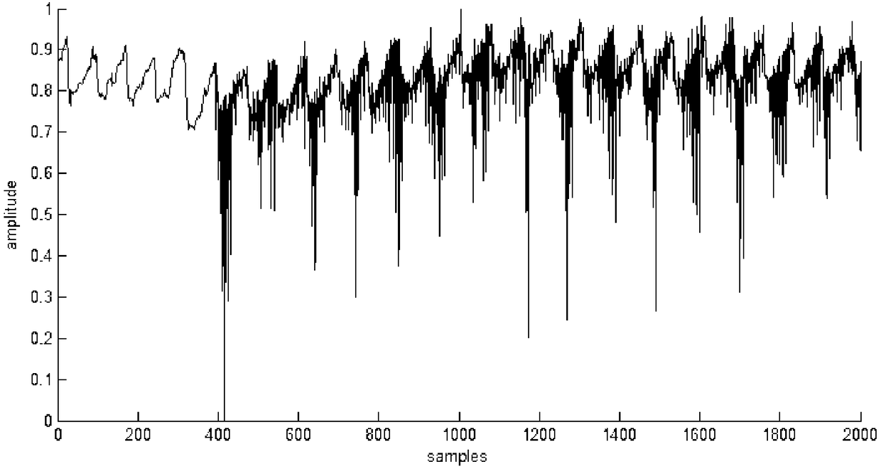 Human pulse wave signal noise suppression method