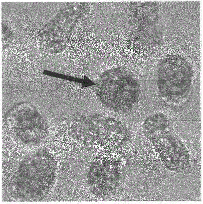 Method for staining actin filaments of suspension cells