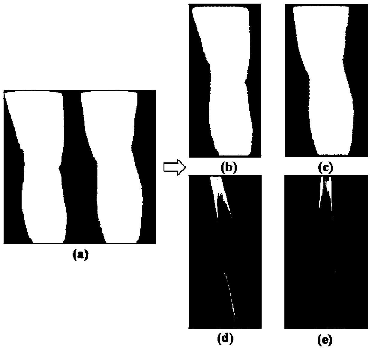 An automatic splicing method, device and terminal equipment applied to X-ray images