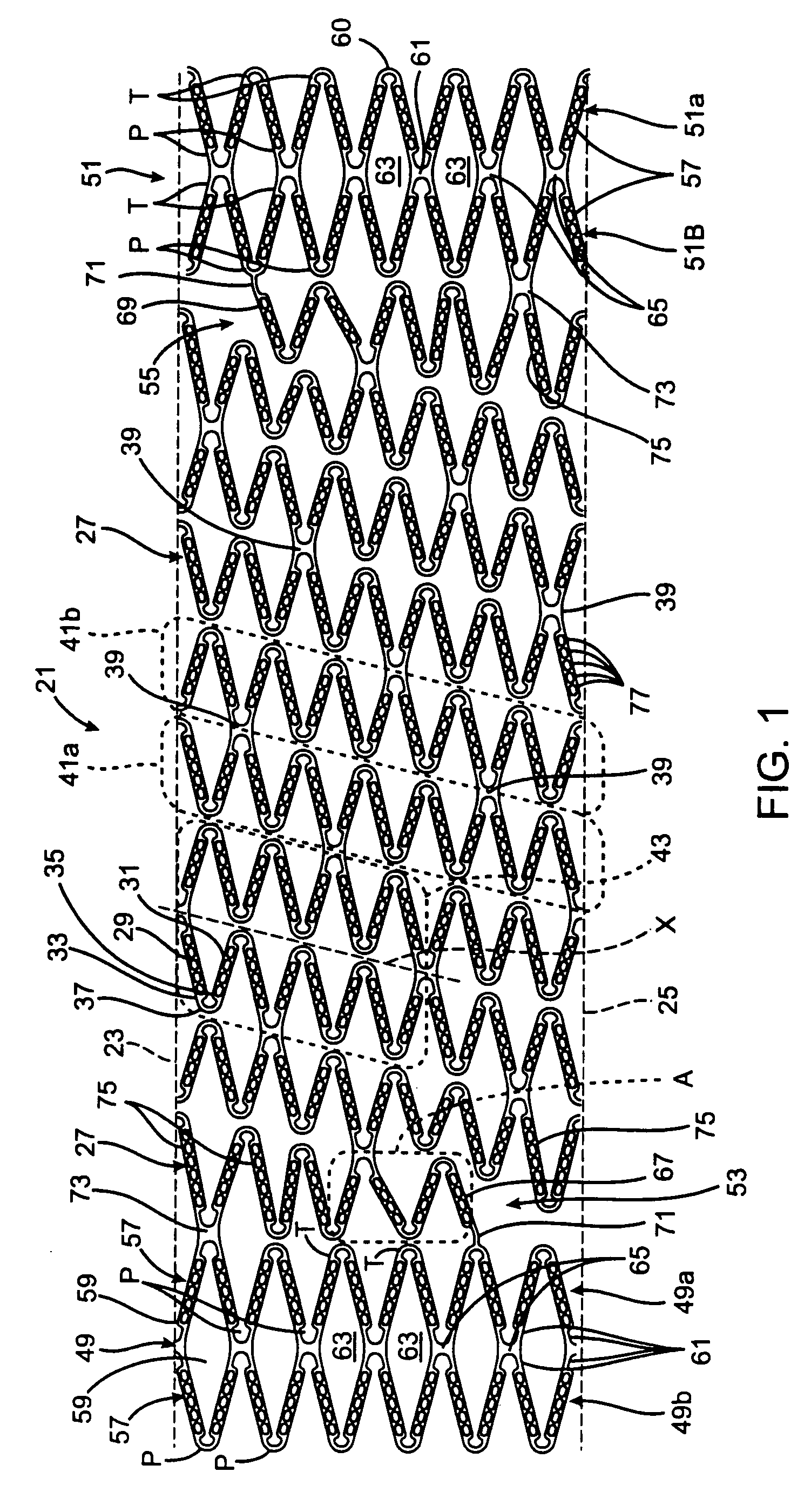 Stent with flexible hinges