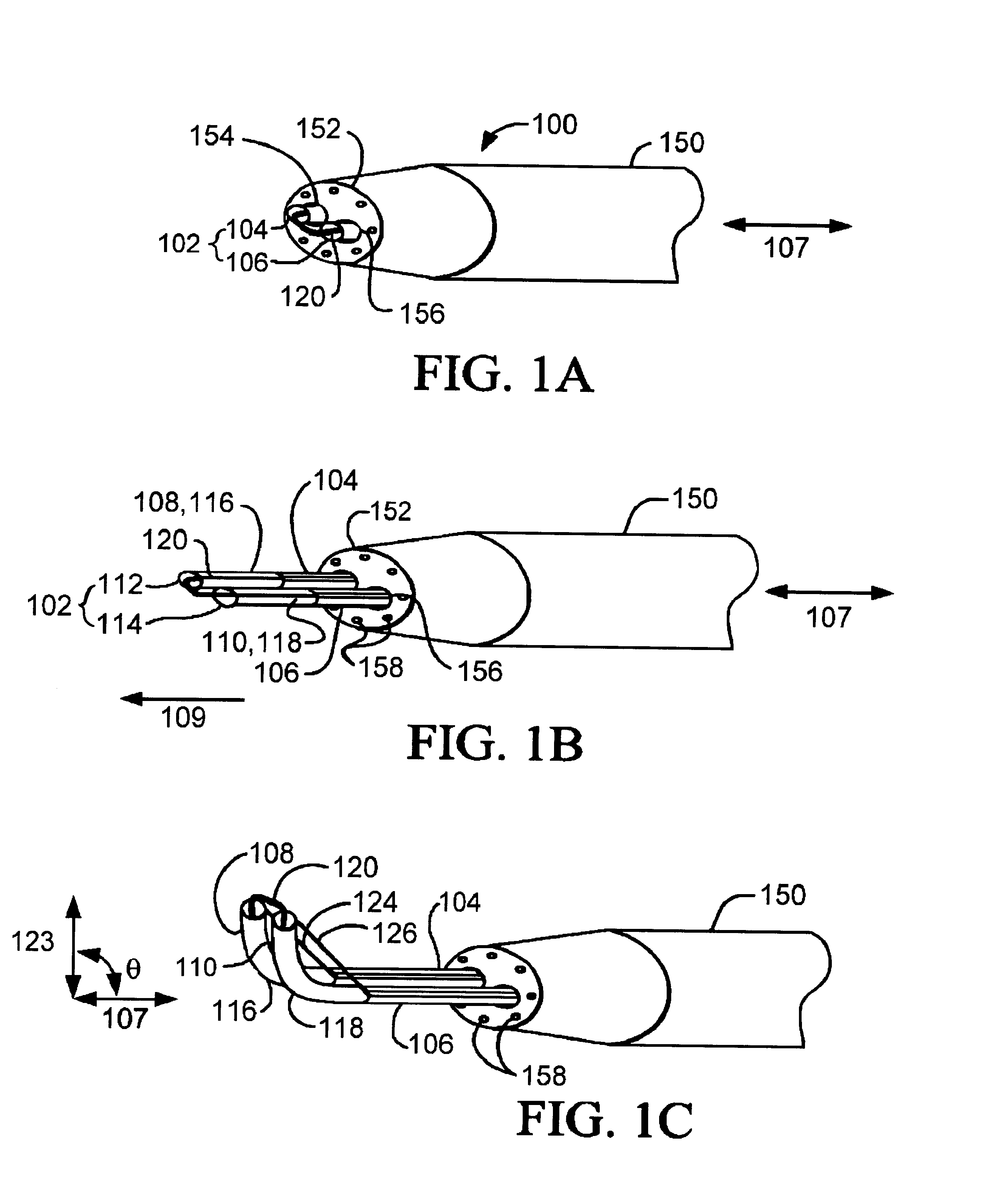 Devices and methods for tissue severing and removal