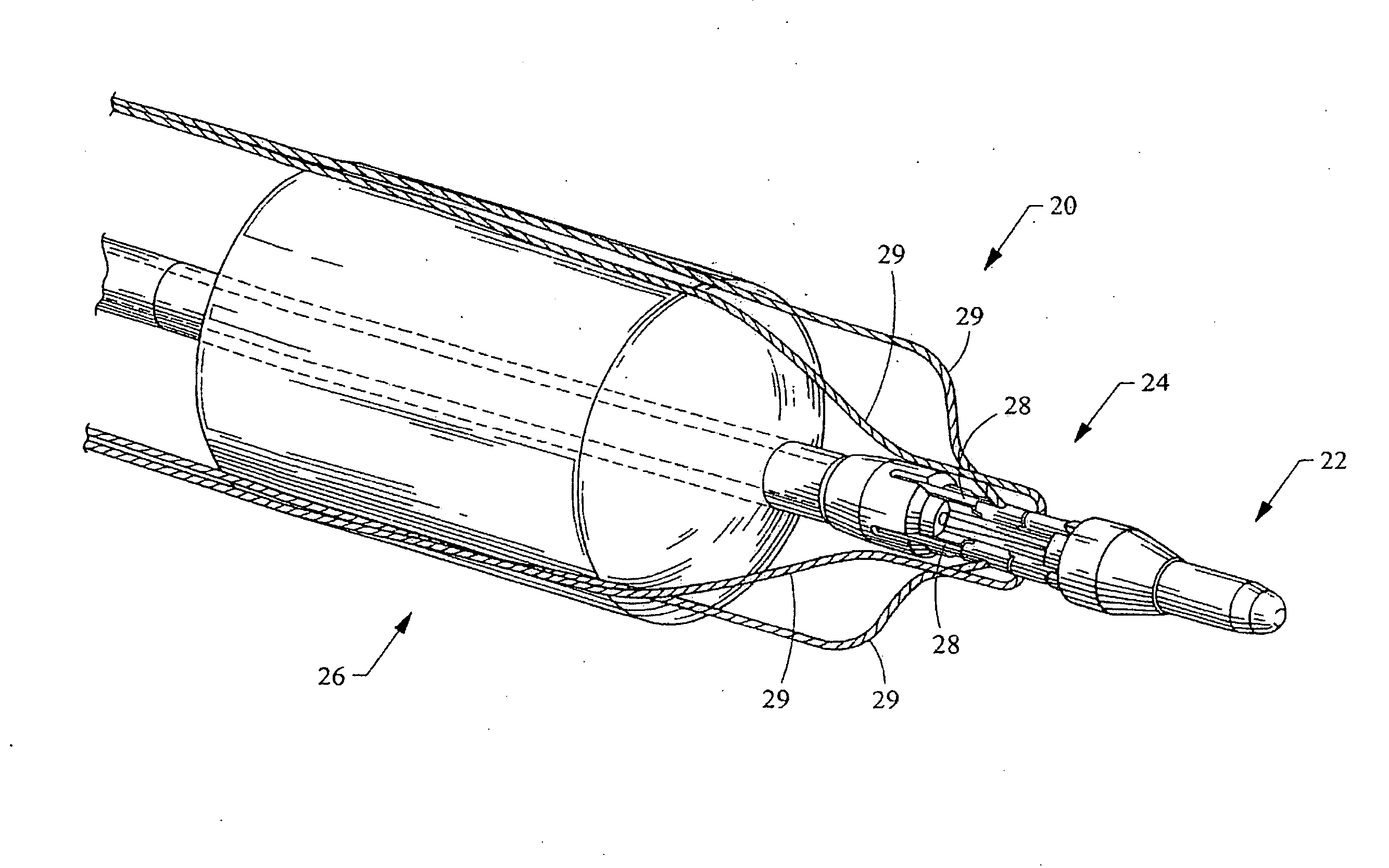 Device to open and close a bodily wall