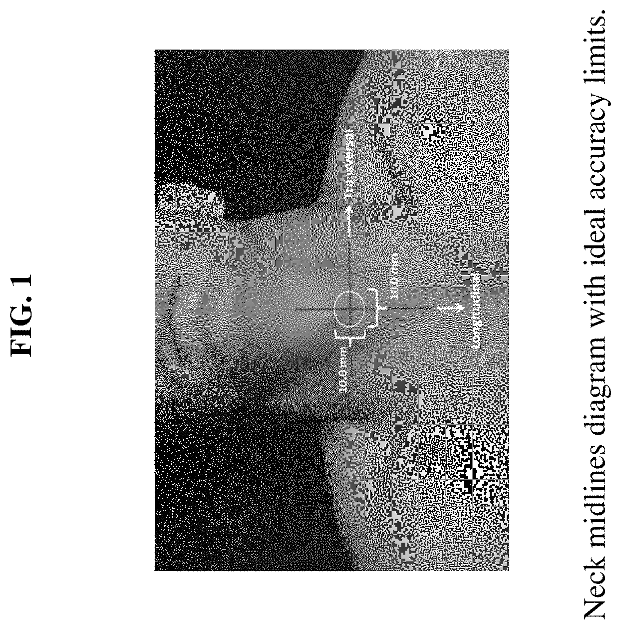 Device for the mechanical detection of underlying tissues