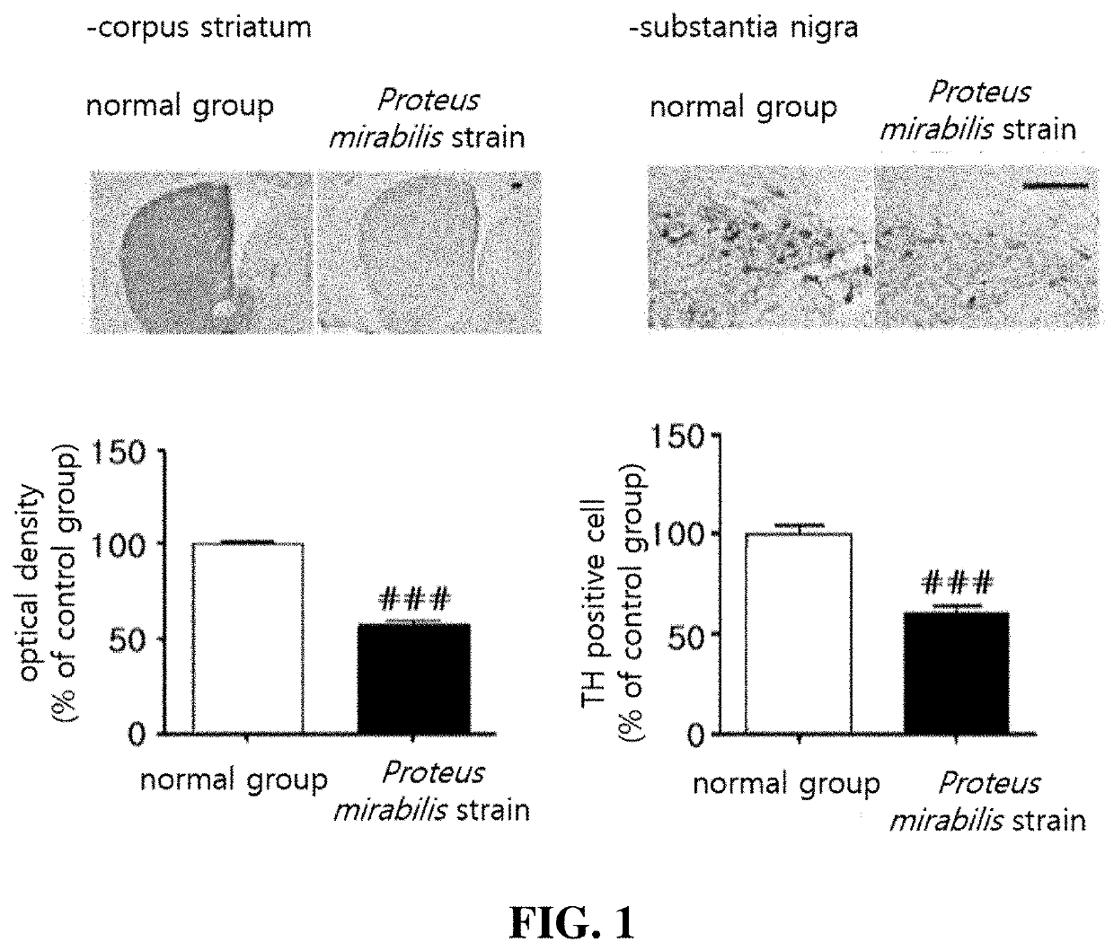 Information providing method for diagnosing parkinsons disease