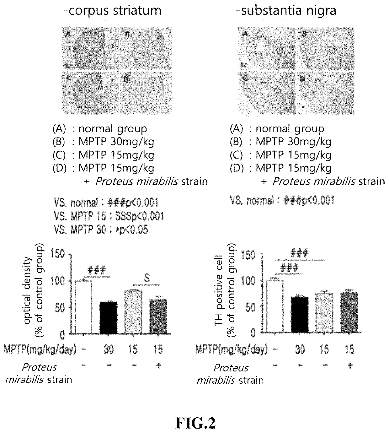 Information providing method for diagnosing parkinsons disease