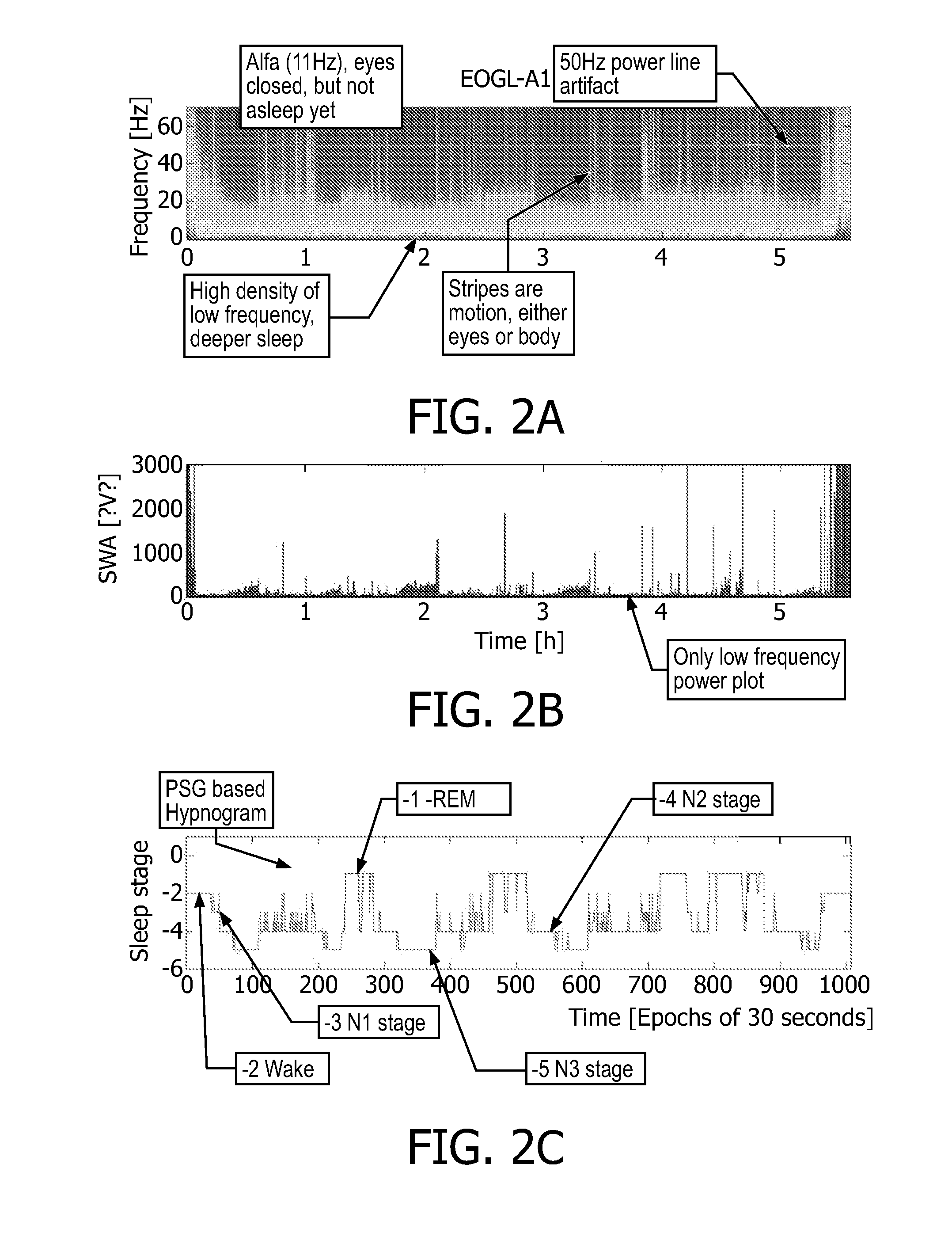Sleep stage annotation device