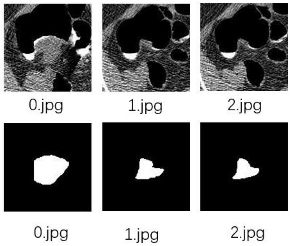 End-to-end colorectal polyp image segmentation method based on effective learning