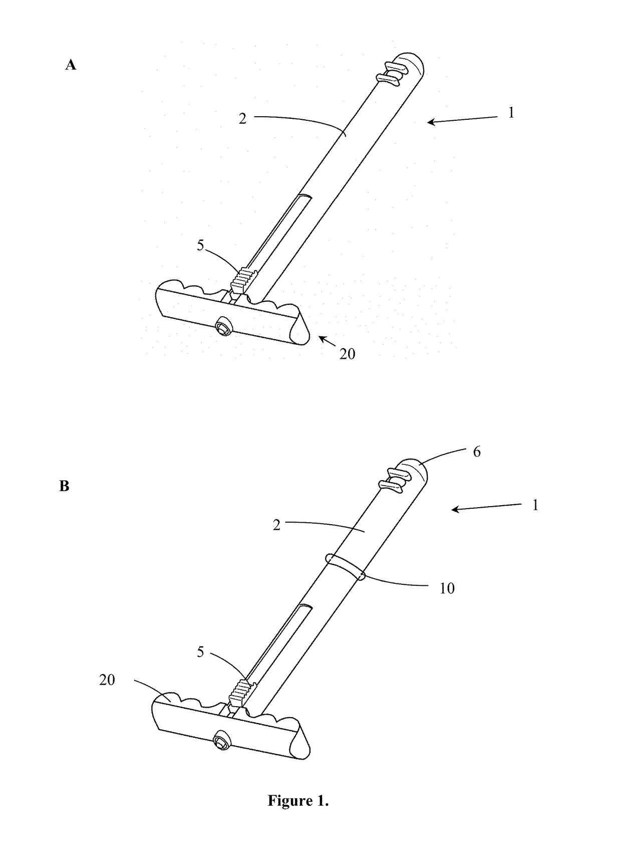 Transvaginal specimen extraction device