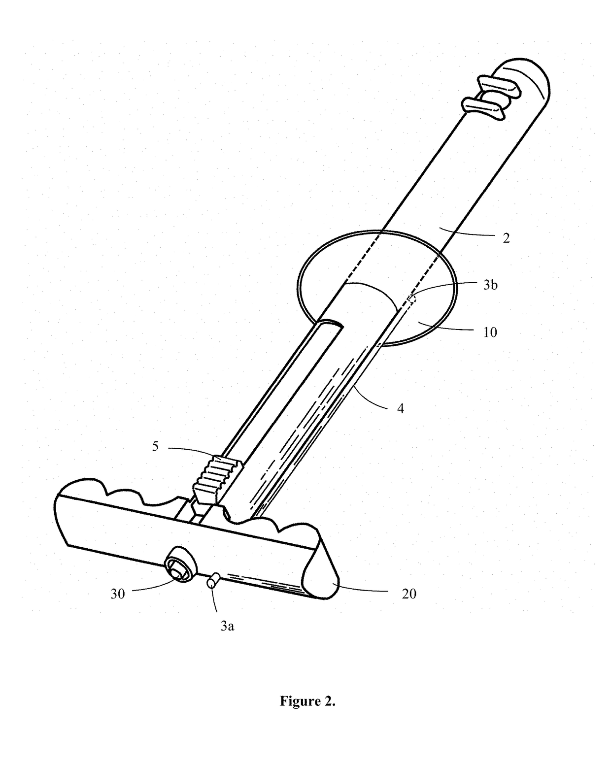 Transvaginal specimen extraction device
