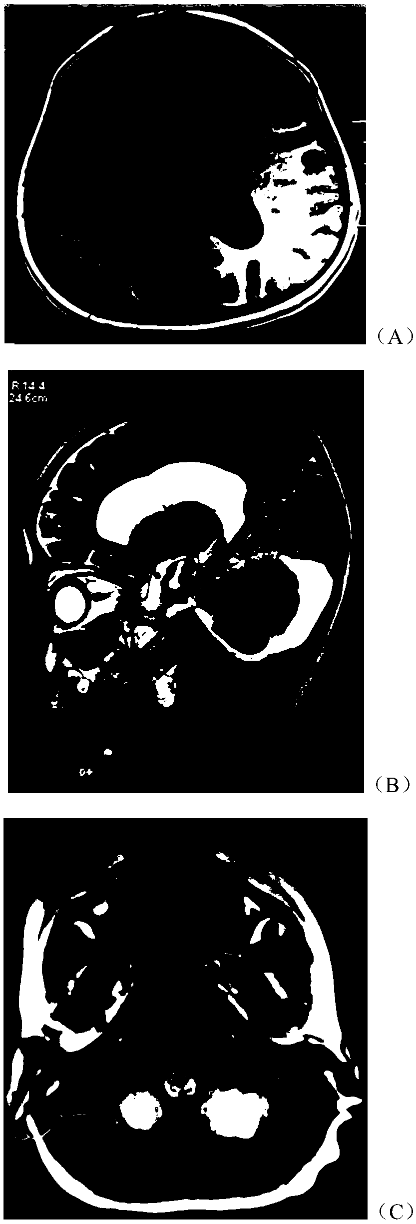 Gene mutant and application thereof