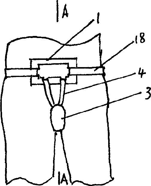 Kidney health-care therapeutic device