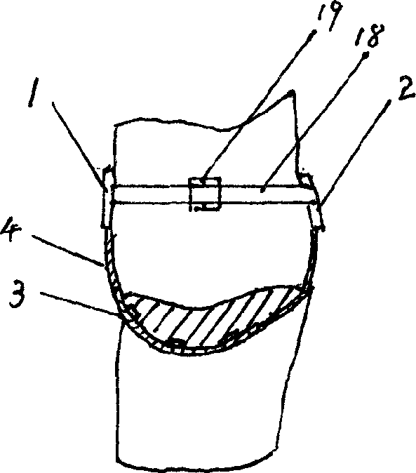 Kidney health-care therapeutic device