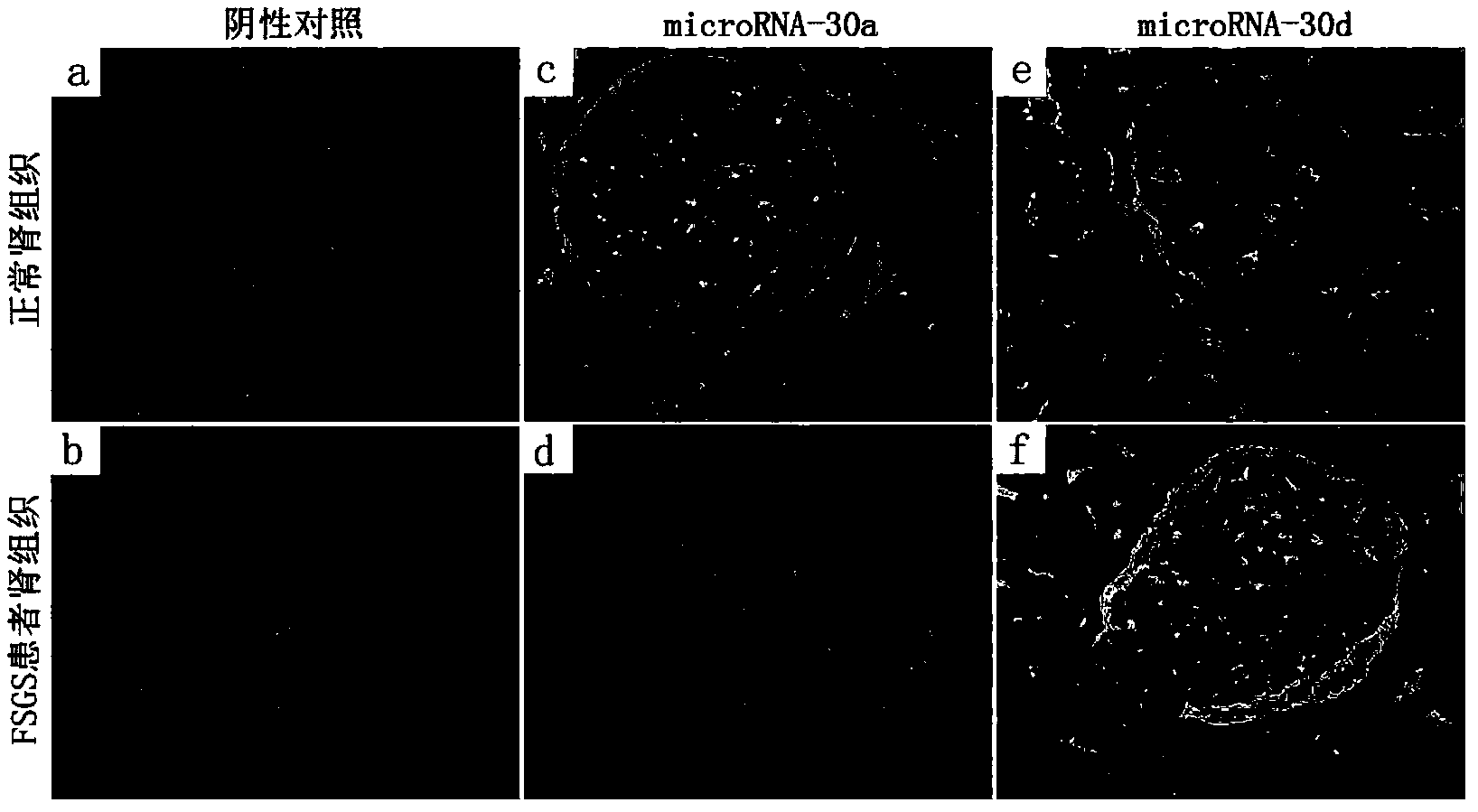 Novel purpose of microRNA-30 family