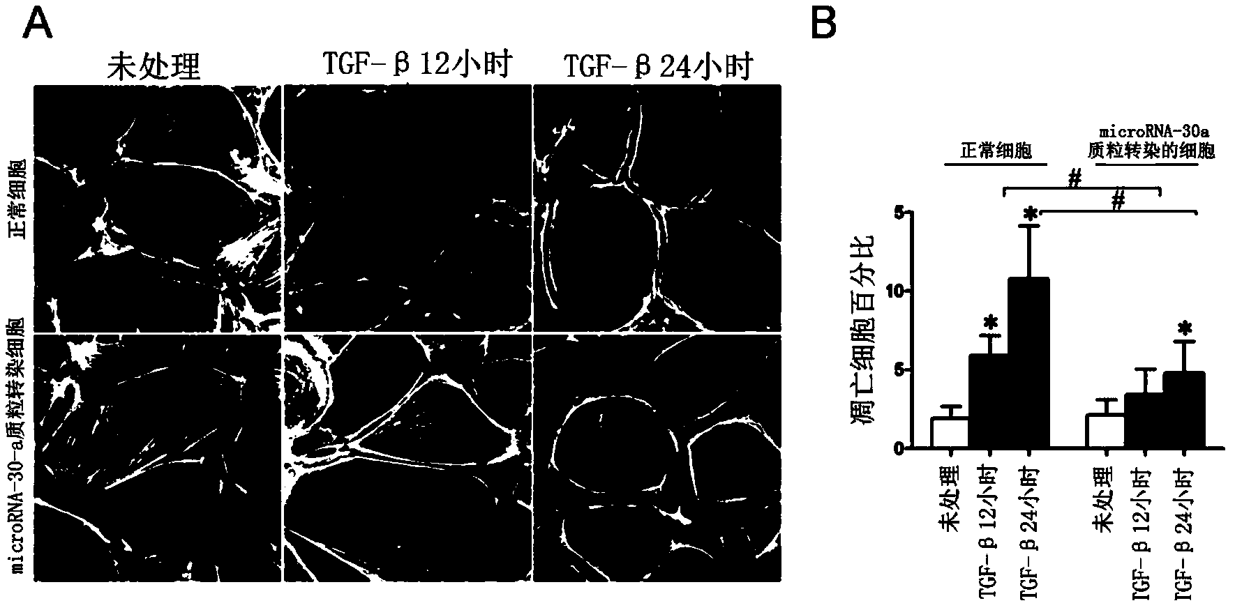 Novel purpose of microRNA-30 family