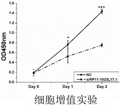 Prostatic cancer molecular target RP11-1023L17.1 and application thereof to diagnostic kit