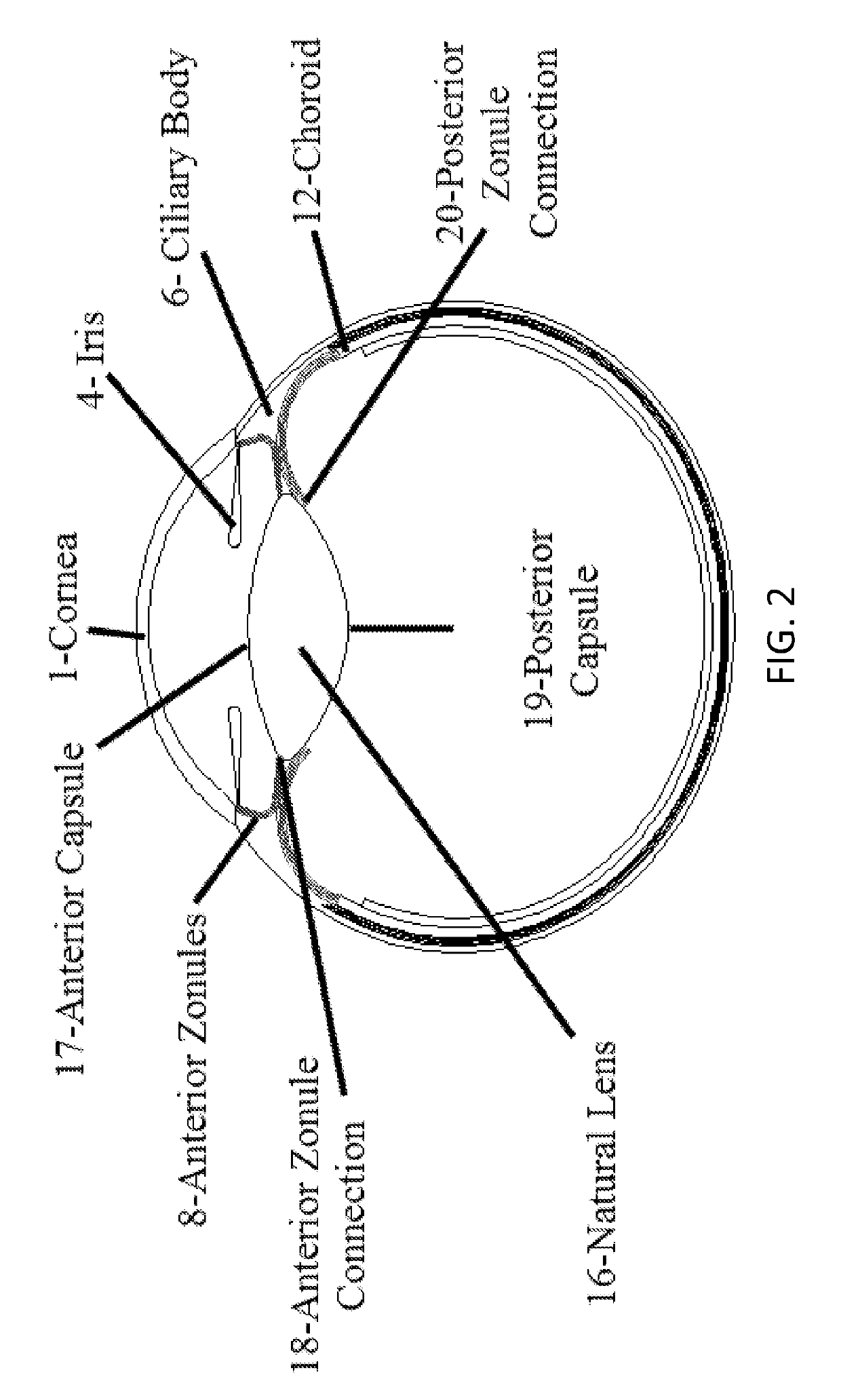 Accommodative intraocular lens that ejects post capsular opacification and self-centers