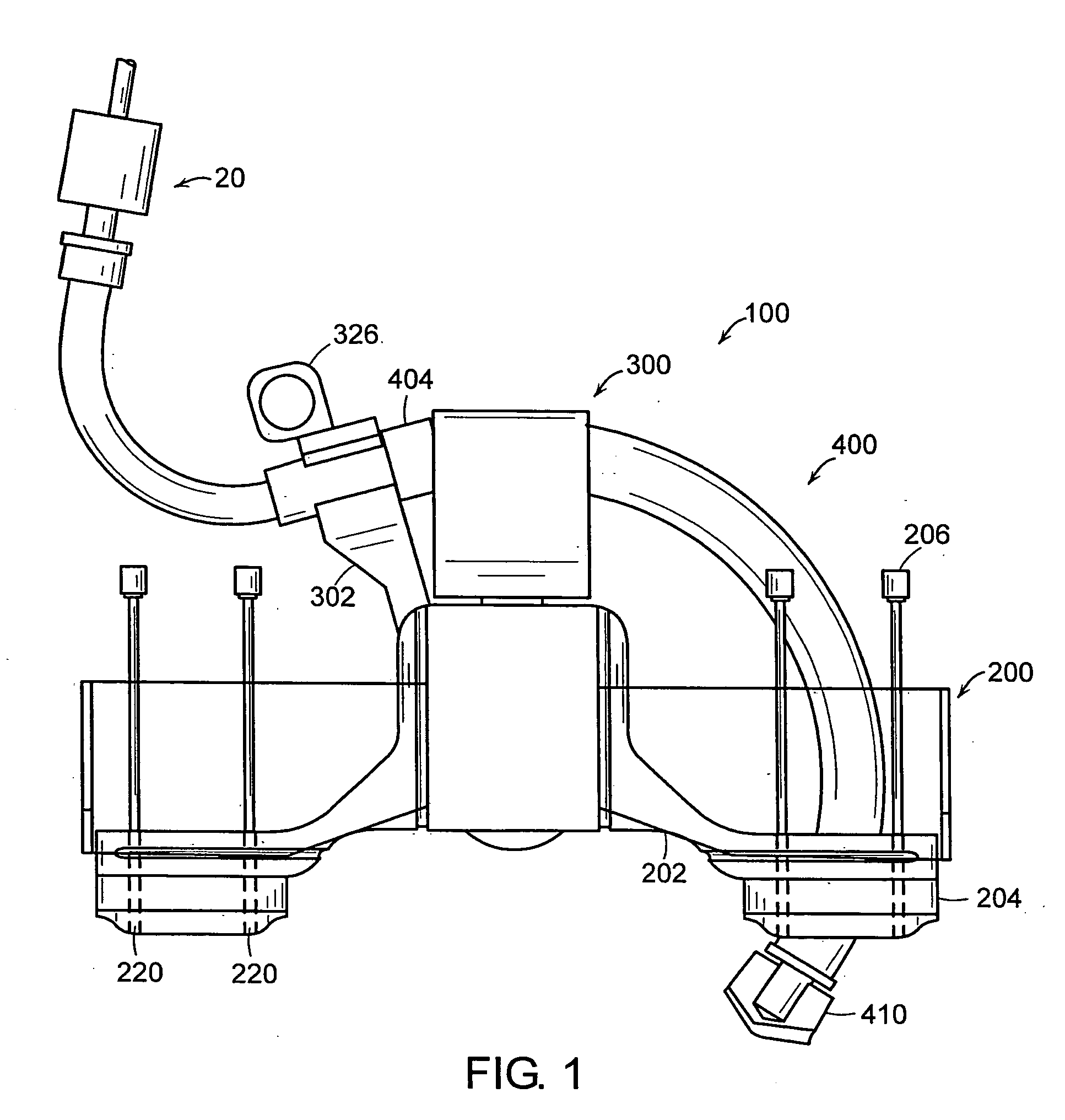 Systems, devices and apparatuses for bony fixation and disk repair and replacement and methods related thereto