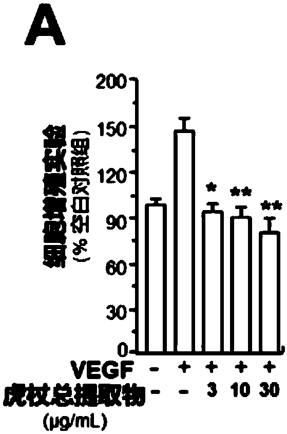 Drug application of polygonum cuspidatum total extract, polydatin or resveratrol