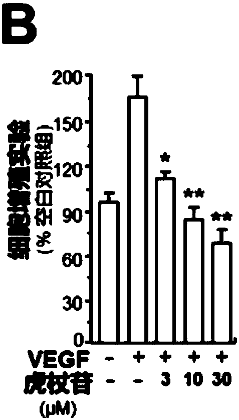 Drug application of polygonum cuspidatum total extract, polydatin or resveratrol