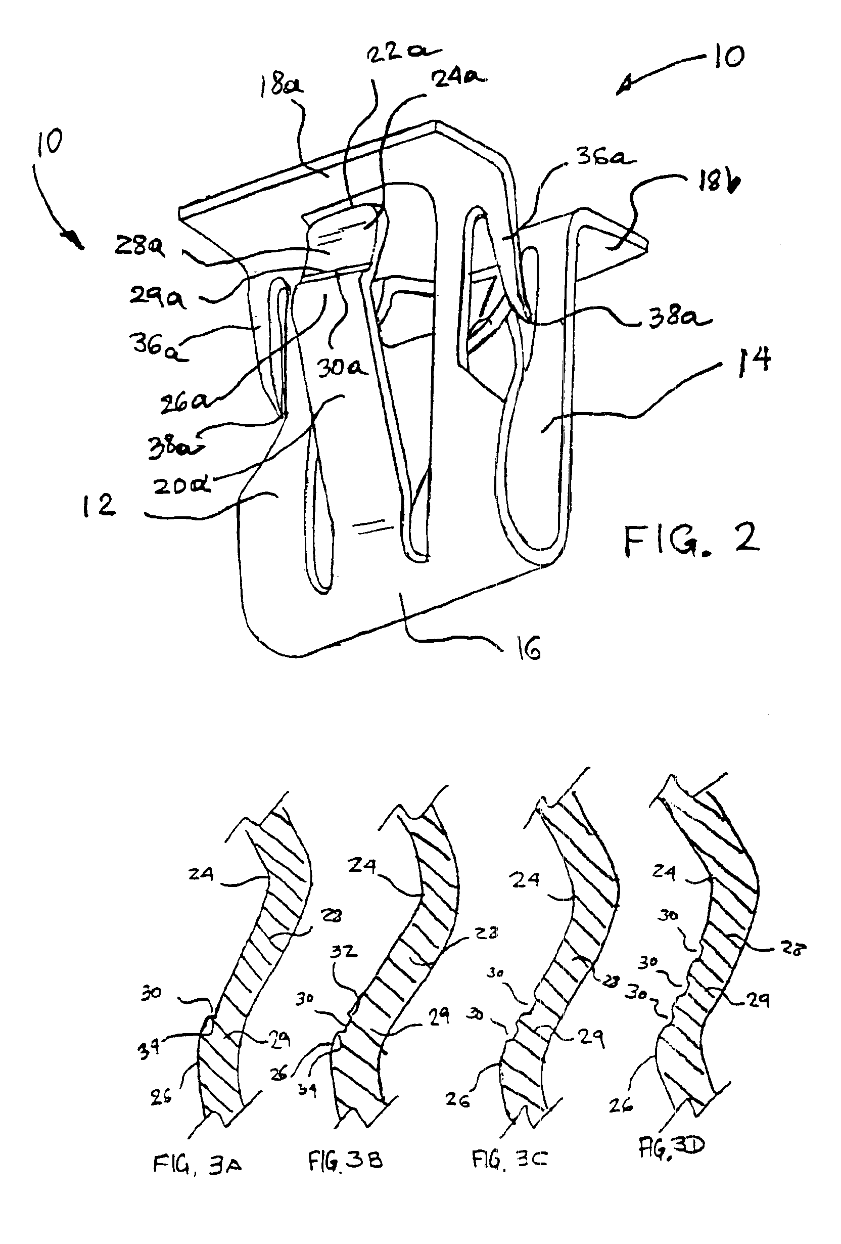 Assemblies comprising fastener with ergonomically balanced removal to insertion ratio