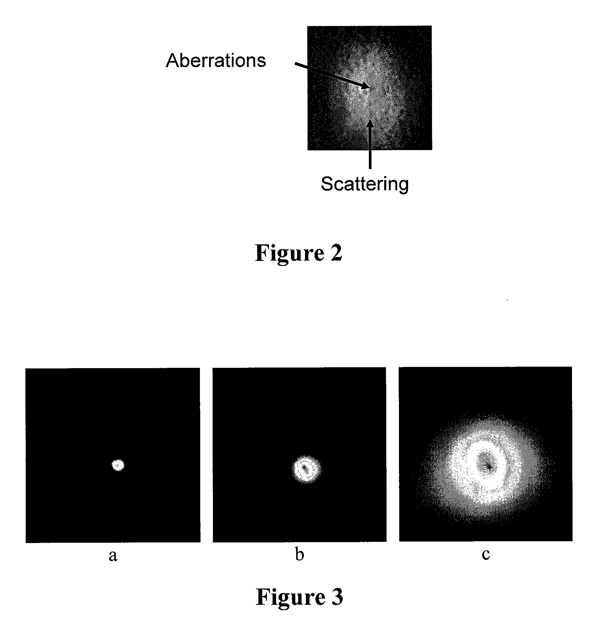 System and method for measuring light scattering in the eyeball or eye region by recording and processing retinal images