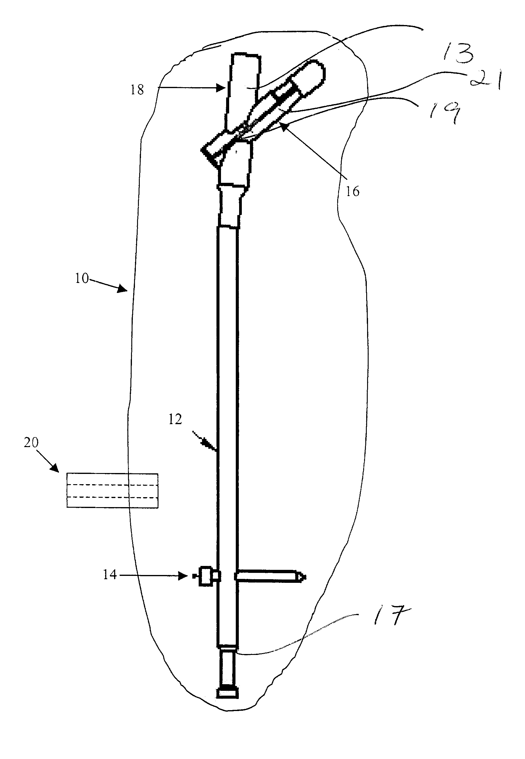 Intramedullary rod with vent