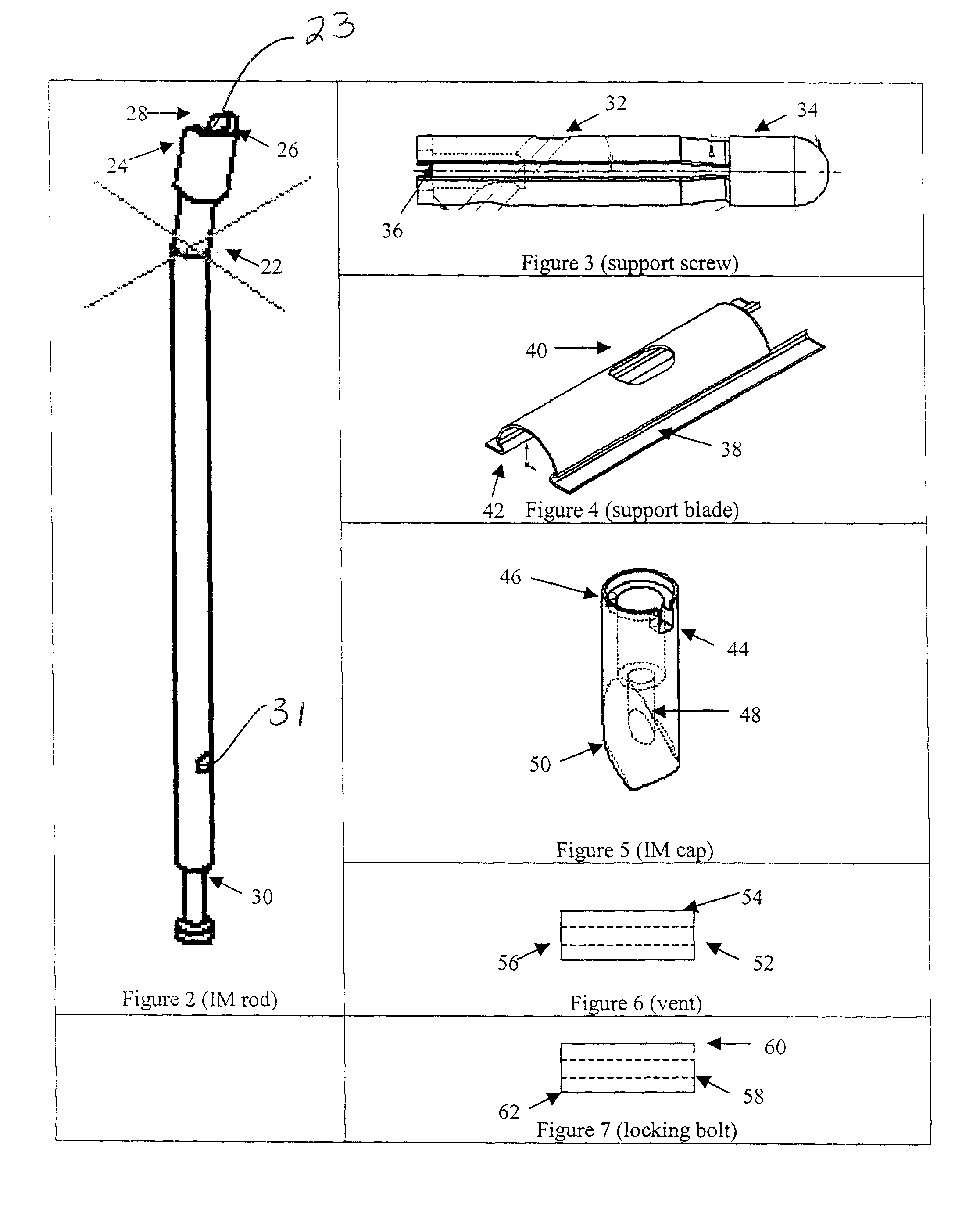 Intramedullary rod with vent