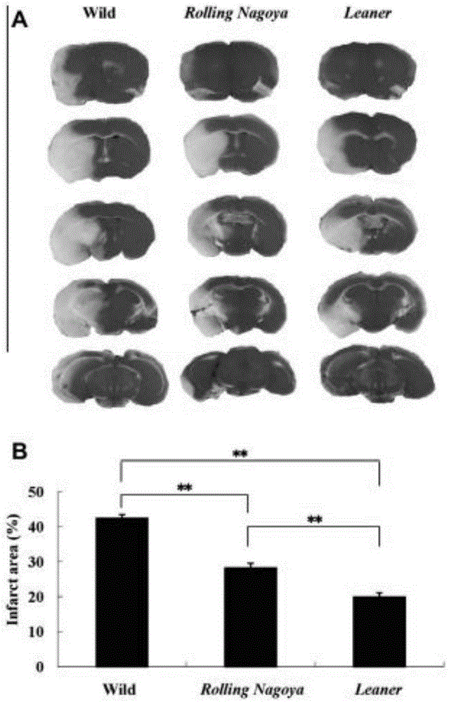 [Ca2+] i reduction of CaV2 1 alpha 1 gene mutation mice in in-vitro ischemia model