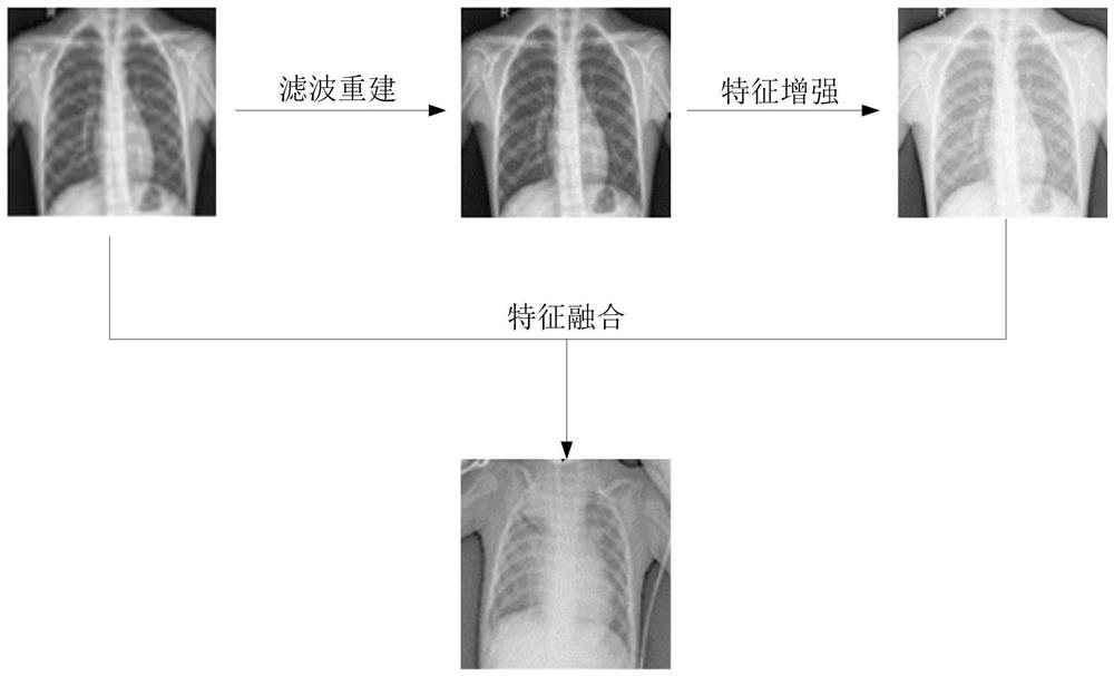 Pneumonia image processing method and system and storage medium